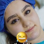 کاشت مو و ابروی لیما