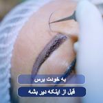 کاشت مو و ابروی لیما
