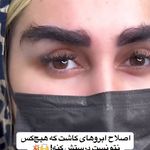 کاشت مو و ابروی لیما