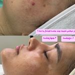 خدمات تخصصی پاکسازی پوست فروغ یزدانی