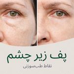 کلینیک طب سنتی و طب سوزنی تای چی