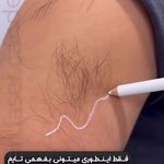 مرکز لیز ونک بیوتی،الکس کندلا ۲۰۲۶
