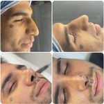 کلینیک زیبایی الماس کاملا اقساطی