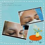 مرکز لیزر نیکی