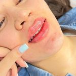 مرکز لیزر و کلینیک پوست مو زیبایی سپید