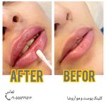 مرکز زیبایی,بوتاکس و لیزر آروشا