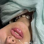 مطب زیبایی دکتر نلسا