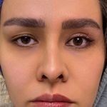 کلینیک پوست وزیبایی ومرکز تخصصی فیلربادی