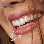 کلینیک دندانپزشکی تیدنتا