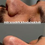 مطب زیبایی آرا