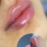 کلینیک لیزر و زیبایی مهسان
