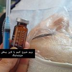 مژگان اسکین کرMojgan skincare