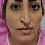 کلینیک زیبایی الماس کاملا اقساطی