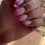 کاشت ناخن گیسو