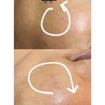 مرکز تخصصی فیشال و پاکسازی پوست حنانه