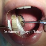 دندانپزشکی دکتر حامد رضایتی تبار