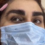 کلینیک پوست زیبایی کاشت مو و ابرو ونوس