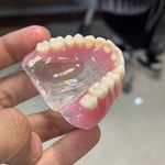 ساخت تخصصی دندان مصنوعی (ایران دنت)