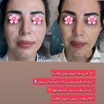 مرکز لیزر و کلینیک زیبایی پریفا