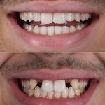 دندانپزشکی دکتر هومن باقری (بیمه نداریم)