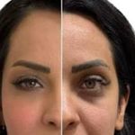 کلینیک ژل بوتاکس لیزر فیل بیوتی