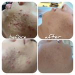 پاکسازی پوست وفیشال تخصصی فاطیما