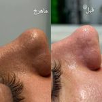 خدمات فیشال پاکسازی/اسکالپ اسکراپ ماهرخ