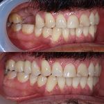 دنداپزشکی دکتر یاشار معزز