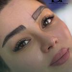 میکروبلیدینگ درسا بافرانی