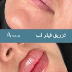 مجموعه زیبایی آتیماه