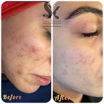 خدمات تخصصی فیشال سارا اسکین بار