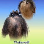 موسسه آموزش و درمان انواع ریزش مو ریشه
