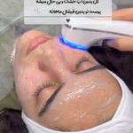 فشیال و پاکسازی پوست مهشید