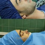 عمل بینی ملل کلینیک