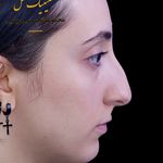 عمل بینی ملل کلینیک