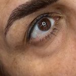 ریموو شیدینگ میکروبلیدینگ