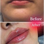 کلینیک پوست ، مو و لیزر ویش