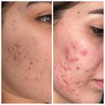 پاکسازی پوست میناصداقتی