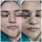 پاکسازی پوست میناصداقتی