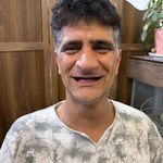لابراتوار دندانسازی شید