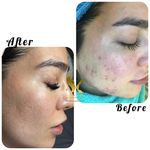 خدمات تخصصی فیشال سارا اسکین بار