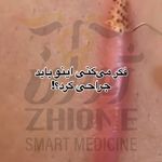 مرکز پی آر پی تهران