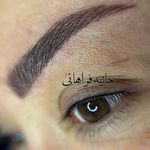 حانیه فراهانی،بنمژه،شیدینگ لب بدون دردقم