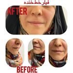 کلینیک زیبایی دکتر میترا جعفرزاده