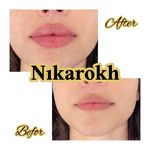 کلینیک پوست و زیبایی و لیزر نیکارخ