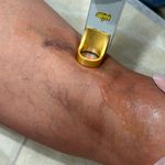 مرکز تخصصی لیزر باران