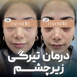کلینیک زیبایی مانشید