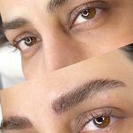 میکروکیماسی( میکروابرو چشم لب،ریمو)