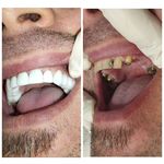 دندانپزشکی اقساطی یاس درپرند