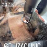 کلینیک تخصصی پوست و مو لیزر‌موهای زائد الیزا